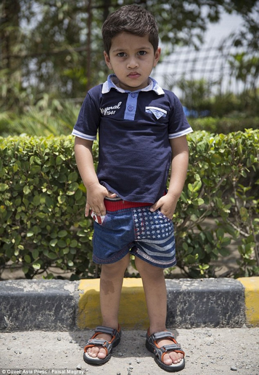 Un bebé de dos años de la India sufre pubertad prematura