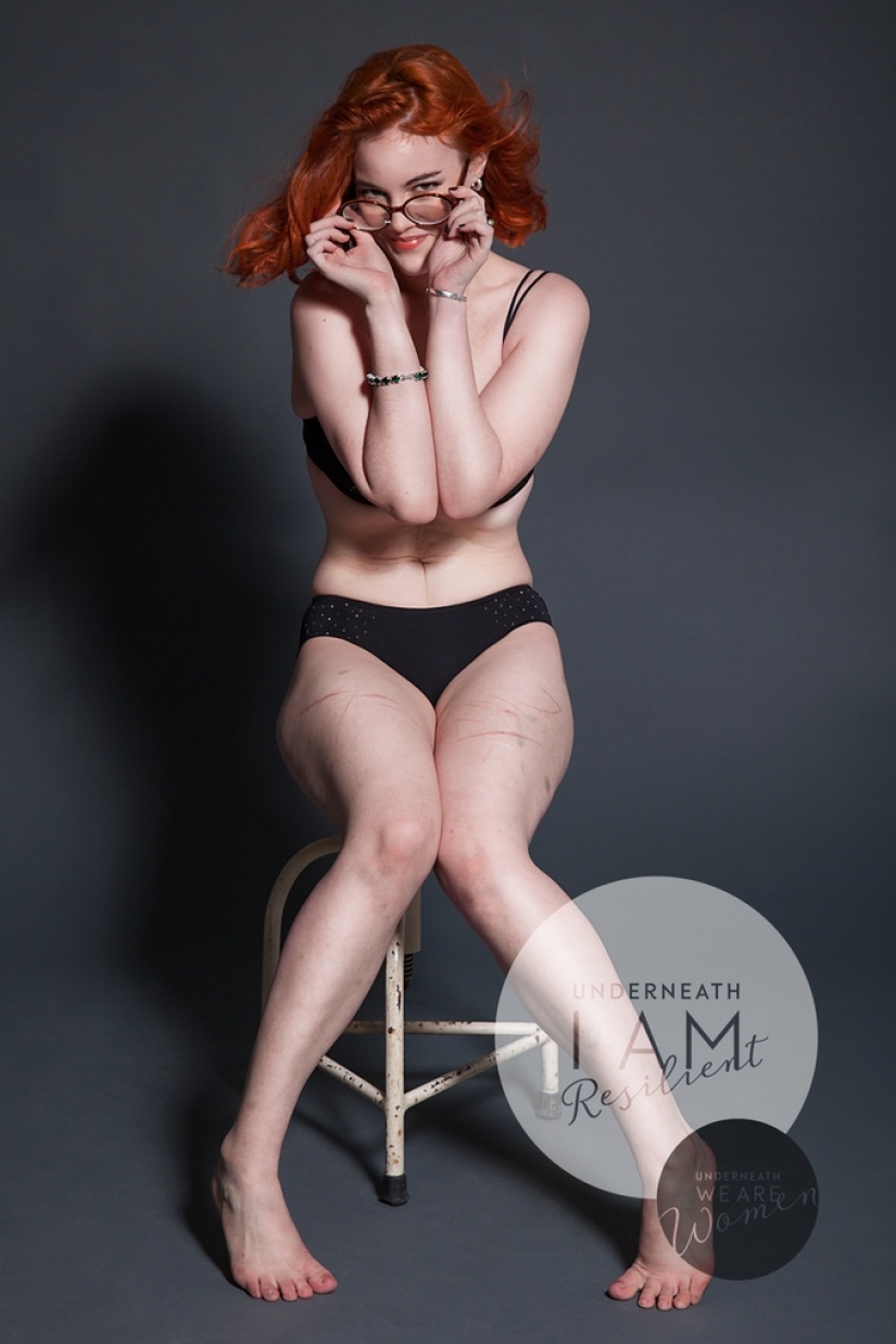 Un fotógrafo australiano ha fotografiado a 100 mujeres comunes en lencería como parte de un proyecto fotográfico positivo para el cuerpo