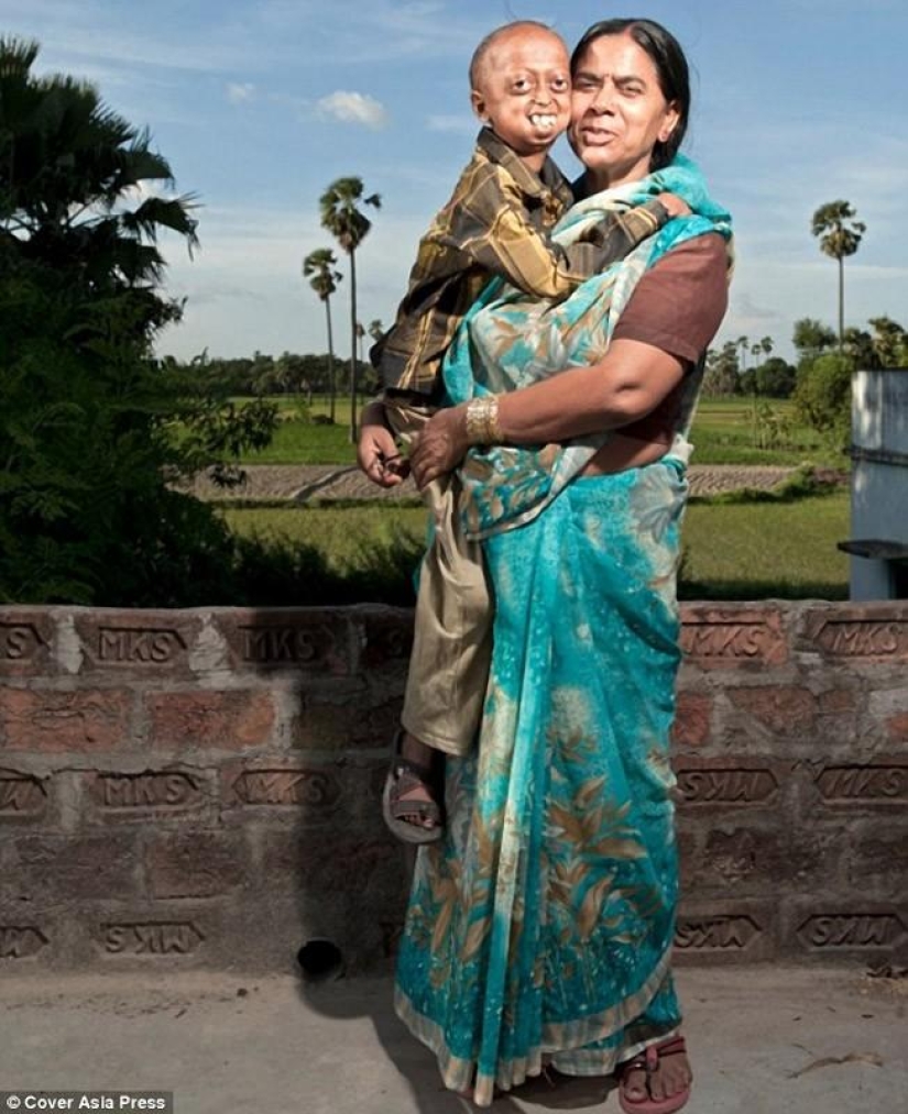 Una enfermedad muy rara convirtió al niño en un pensionista