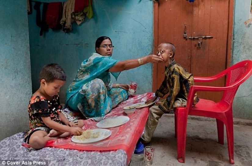 Una enfermedad muy rara convirtió al niño en un pensionista