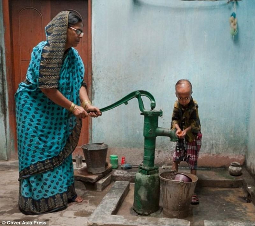 Una enfermedad muy rara convirtió al niño en un pensionista