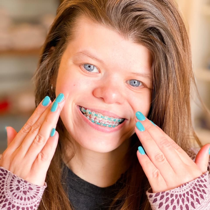 Una mujer británica sufre una rara enfermedad que la hace enamorar a todos los que conoce.