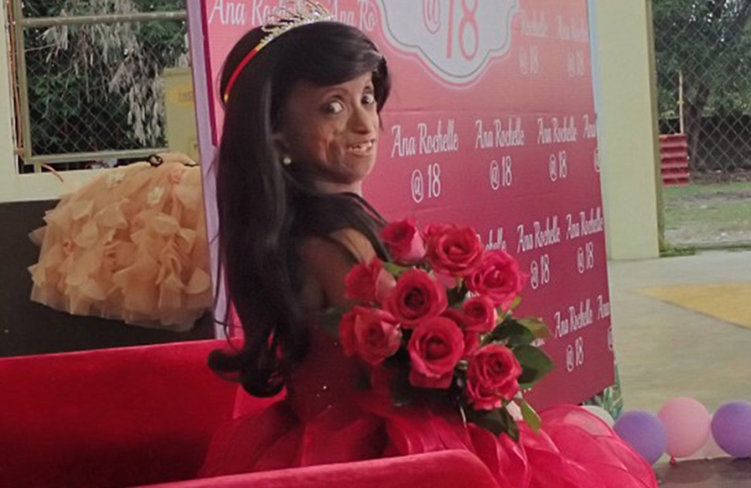 Una niña con el cuerpo de una mujer de 150 años murió en Filipinas