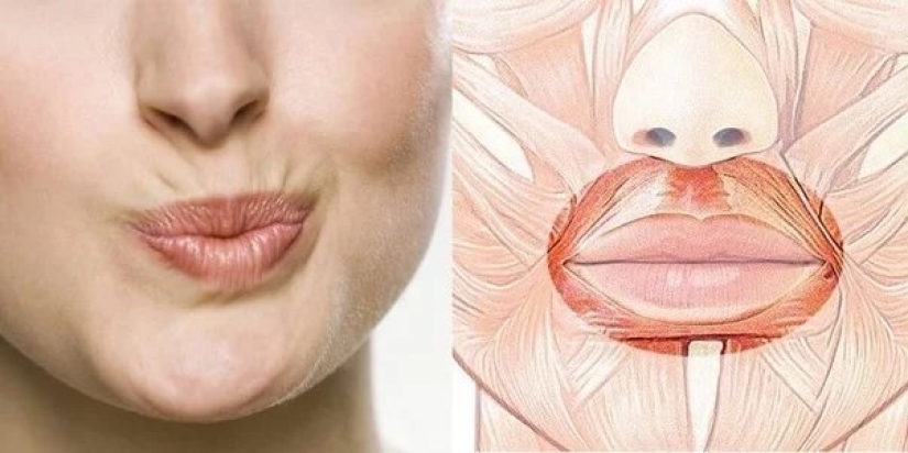 We remove a sad, dissatisfied face along with nasolabial wrinkles and increase the volume of the lips We remove a sad, dissatisfied face along with nasolabial wrinkles and increase the volume of the lips