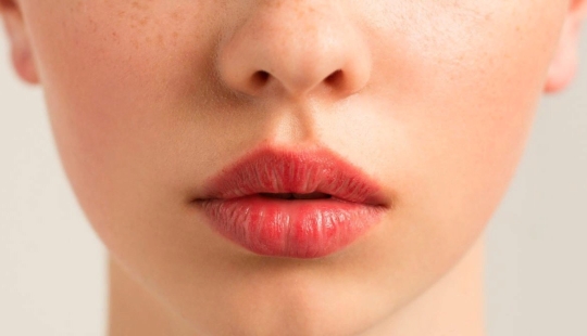 We remove a sad, dissatisfied face along with nasolabial wrinkles and increase the volume of the lips