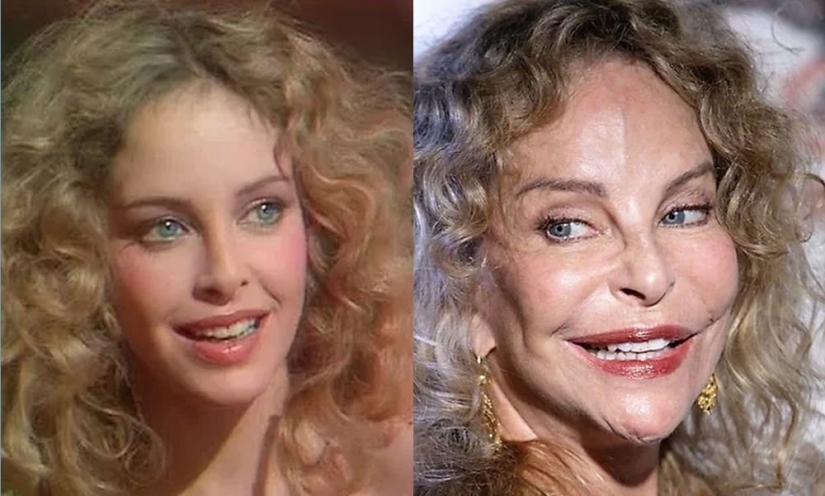 With age, their beauty came to naught: 10 transformations of stars With age, their beauty came to naught: 10 transformations of stars