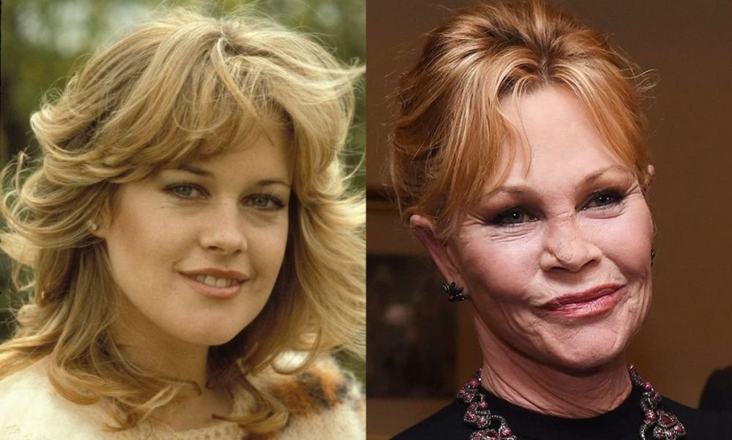 With age, their beauty came to naught: 10 transformations of stars With age, their beauty came to naught: 10 transformations of stars