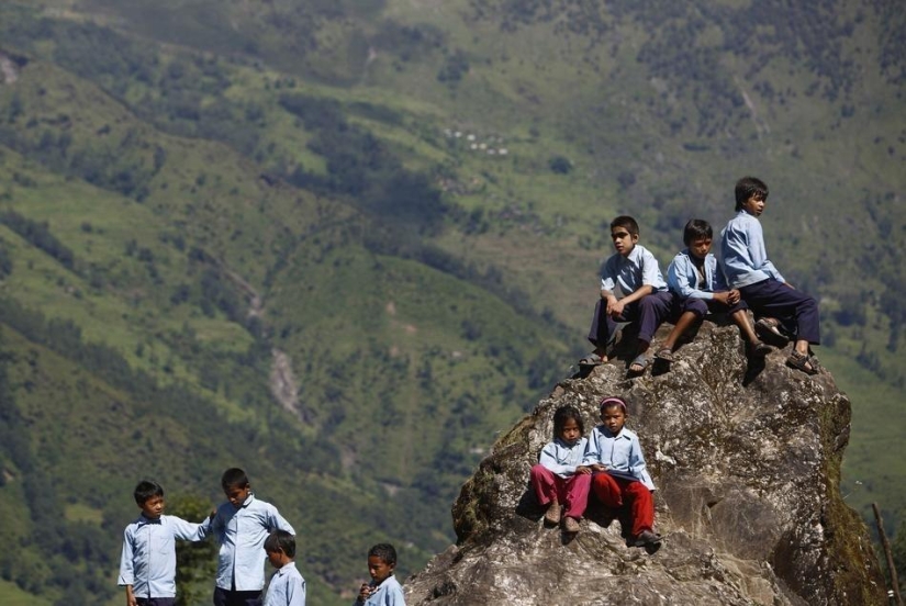 Wolf people, victims of hypertrichosis, underwent laser hair removal