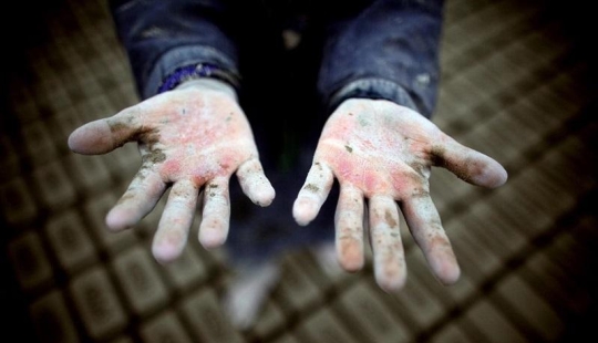 World Day against Child Labor