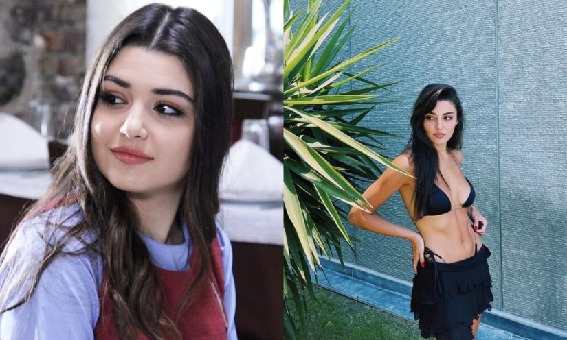 Yours or plastic? All plastic surgeries of Turkish beauty Hande Ercel