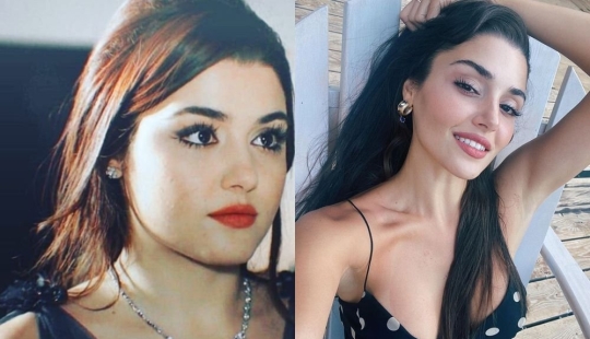 Yours or plastic? All plastic surgeries of Turkish beauty Hande Ercel Yours or plastic? All plastic surgeries of Turkish beauty Hande Ercel