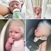 10 fotos de personas que sacaron comodines en la lotería genética