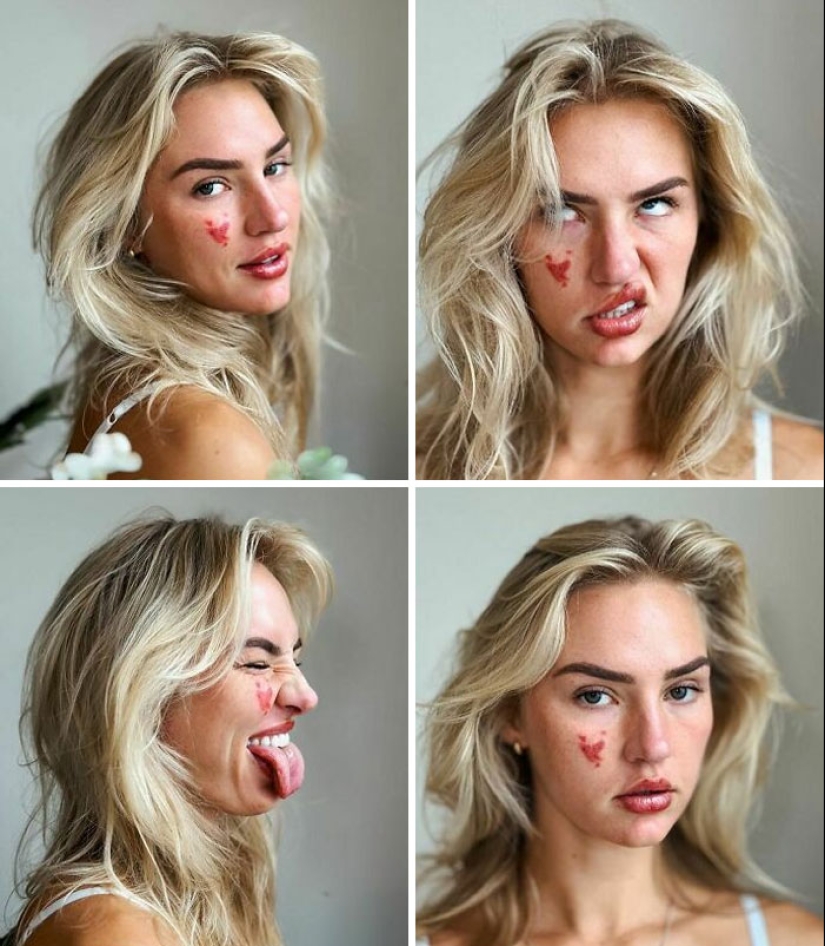 10 fotos de personas que sacaron comodines en la lotería genética