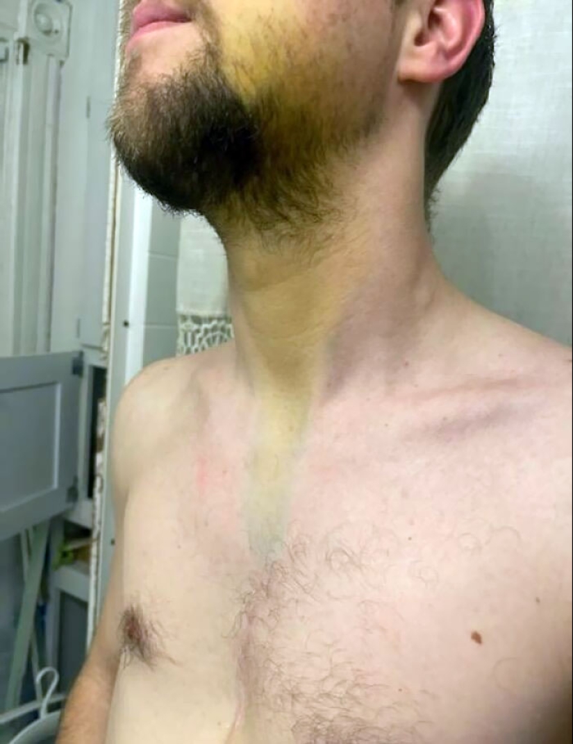 10 Of The Most Unfortunate Things That People Were Forced To Deal With 10 Of The Most Unfortunate Things That People Were Forced To Deal With