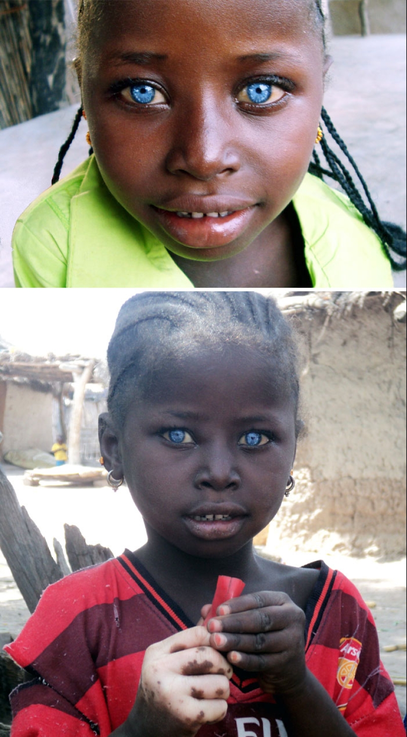 10 Photos Of People Who Drew Wild Cards In The Genetic Lottery