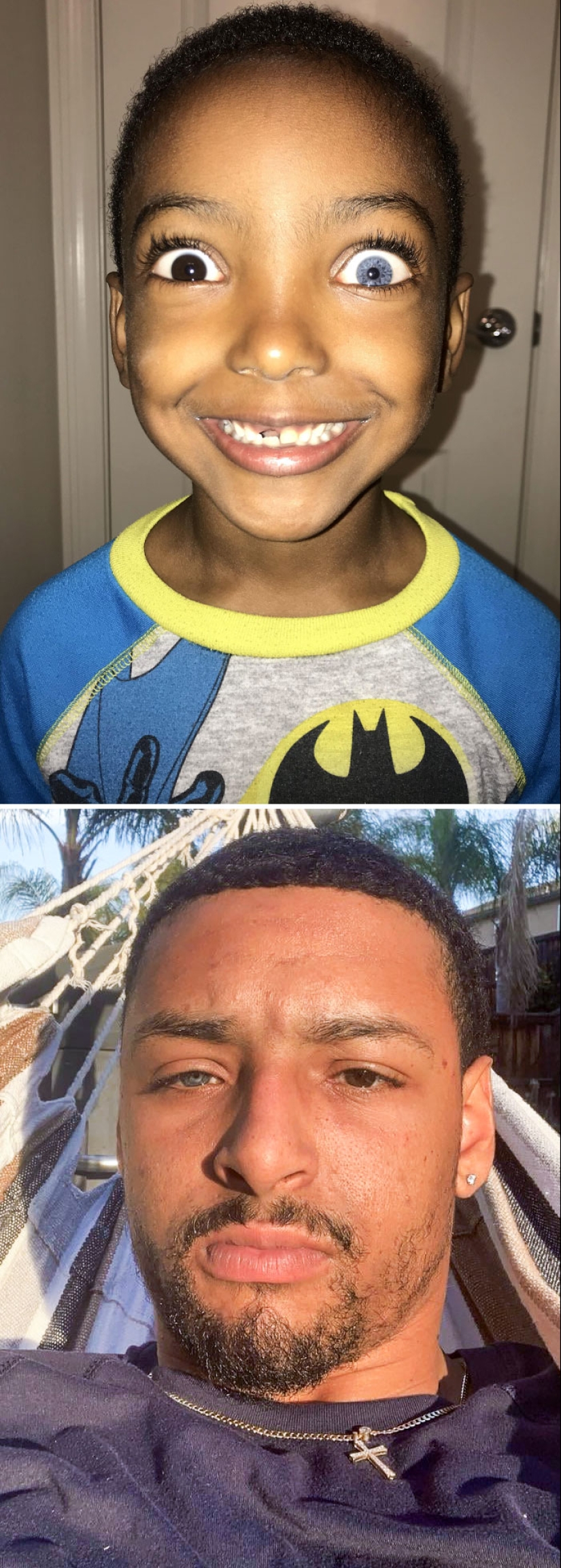 10 Photos Of People Who Drew Wild Cards In The Genetic Lottery