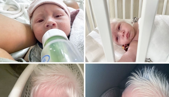 10 Photos Of People Who Drew Wild Cards In The Genetic Lottery