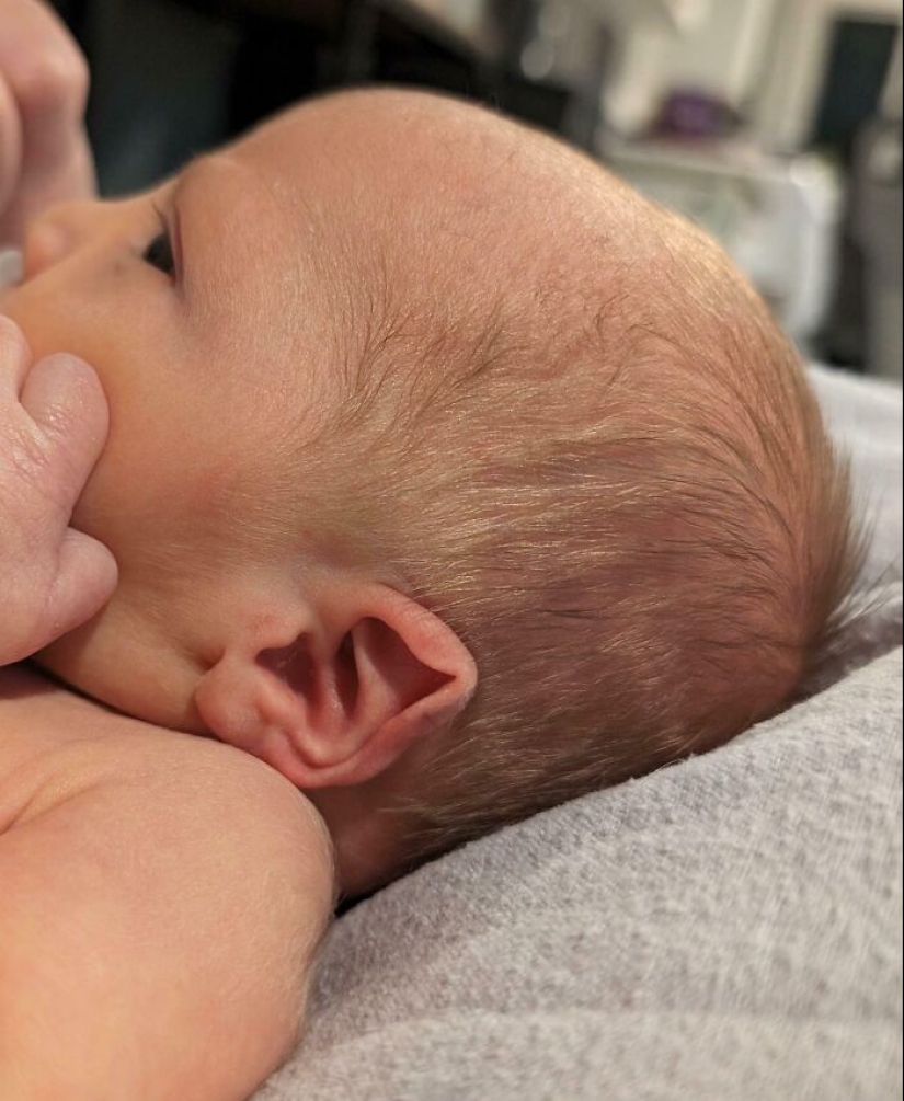 10 Photos Of People Who Drew Wild Cards In The Genetic Lottery