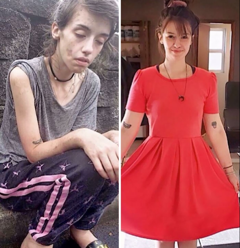 11 Before And After Pictures That Show What Happens When People Overcome Addiction