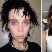11 Before And After Pictures That Show What Happens When People Overcome Addiction