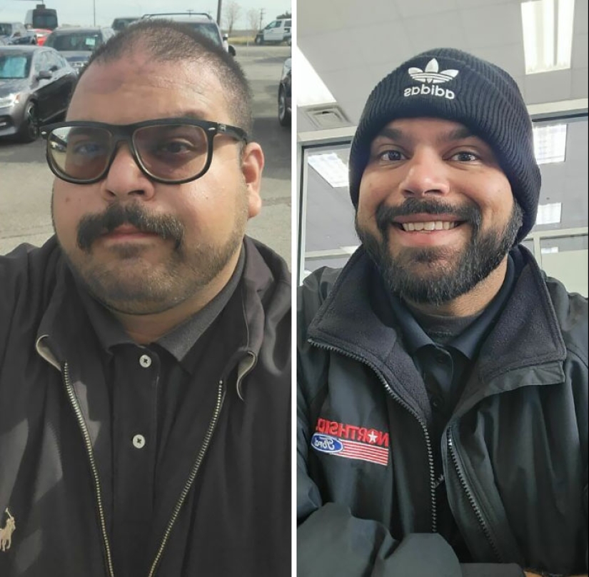 11 Before And After Pictures That Show What Happens When People Overcome Addiction