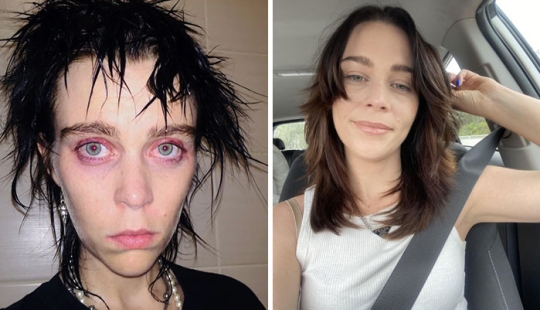 11 imágenes de antes y después que muestran lo que sucede cuando las personas superan la adicción