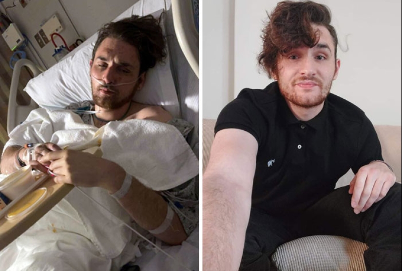 11 imágenes de antes y después que muestran lo que sucede cuando las personas superan la adicción