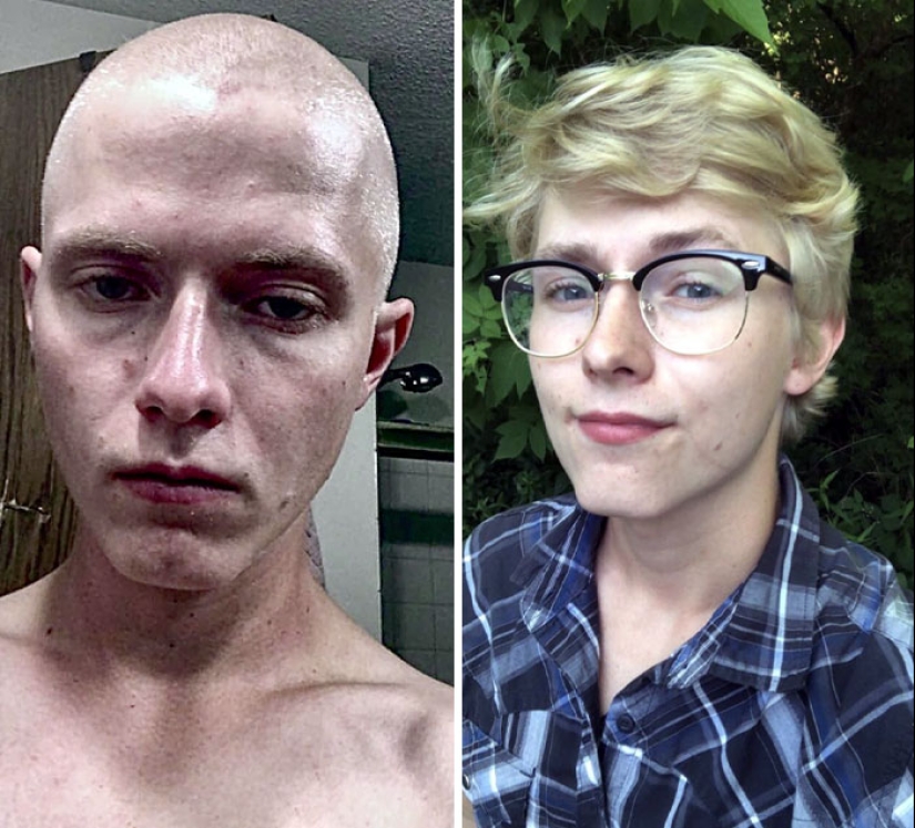 11 imágenes de antes y después que muestran lo que sucede cuando las personas superan la adicción