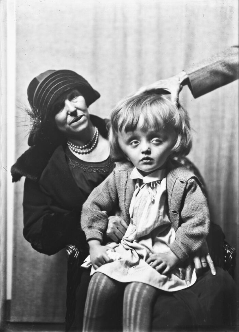 11 inquietantes retratos médicos de los pacientes de Harvey Cushing a principios del siglo XX