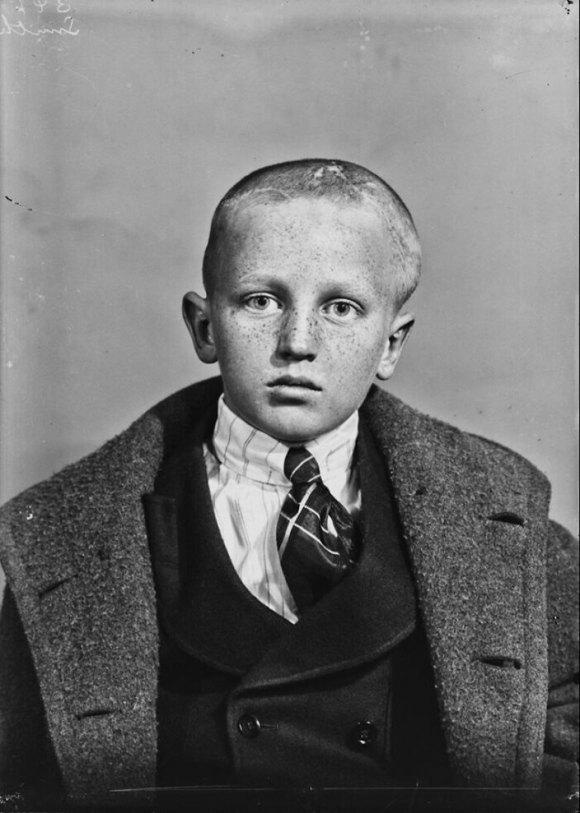 11 inquietantes retratos médicos de los pacientes de Harvey Cushing a principios del siglo XX