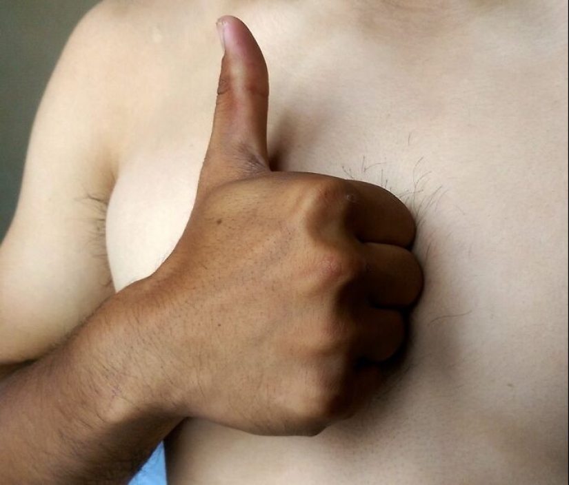 15 People Who Thought They Didn’t Need Sunscreen And Ended Up Looking Like Dorks