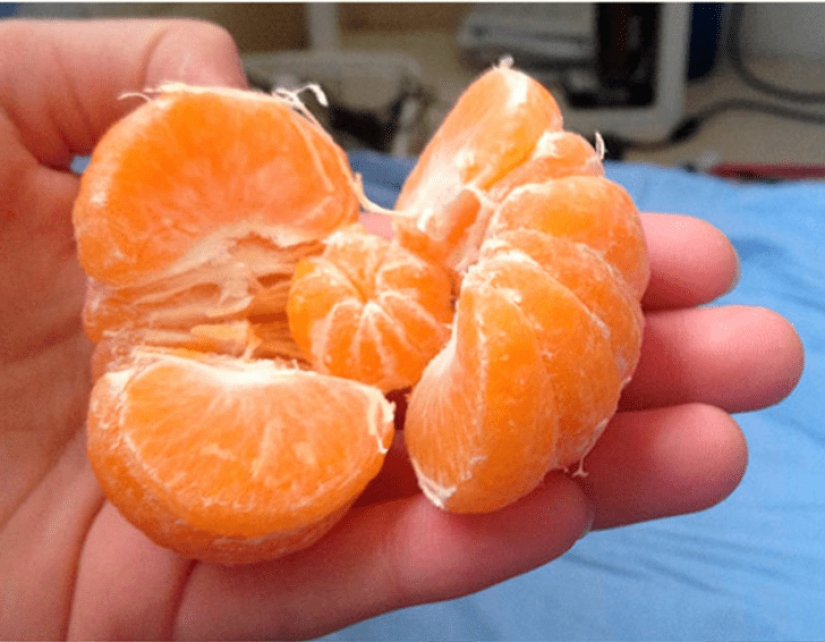 22 cases when someone won the grocery lottery 22 cases when someone won the grocery lottery