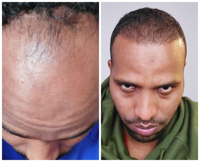 22 fotos de personas que pudieron realizar sus fantasías enfermas