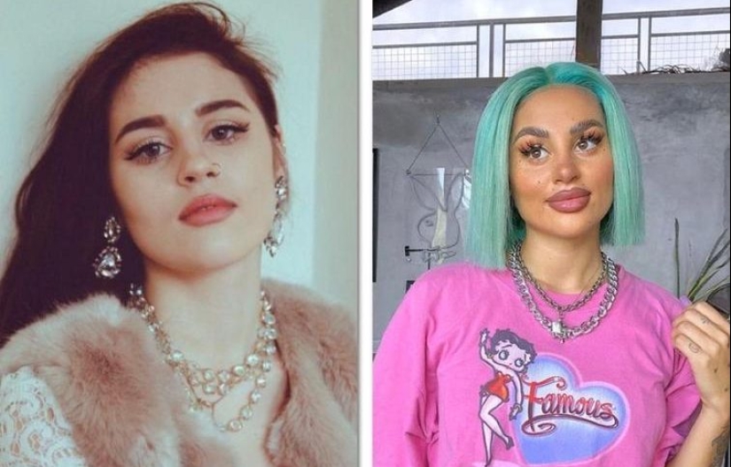 30 people who got carried away with plastic surgery and forgot to stop 30 people who got carried away with plastic surgery and forgot to stop