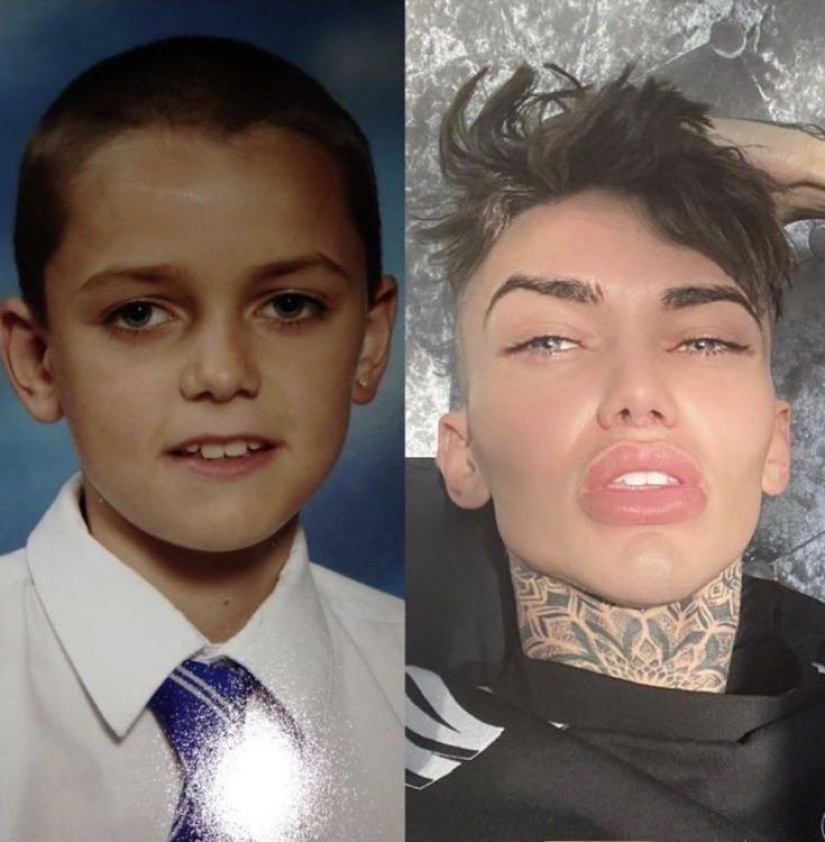30 people who got carried away with plastic surgery and forgot to stop 30 people who got carried away with plastic surgery and forgot to stop
