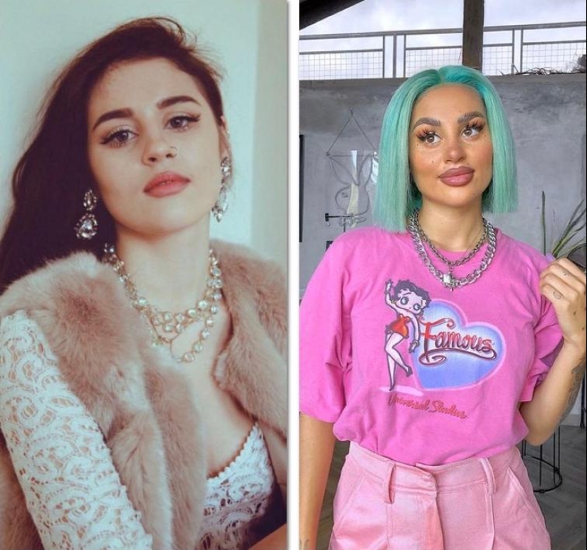 30 people who got carried away with plastic surgery and forgot to stop 30 people who got carried away with plastic surgery and forgot to stop