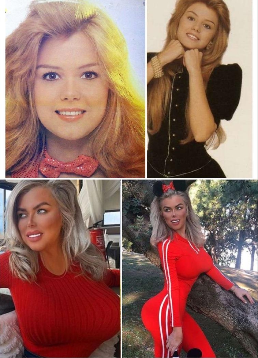 30 people who got carried away with plastic surgery and forgot to stop 30 people who got carried away with plastic surgery and forgot to stop