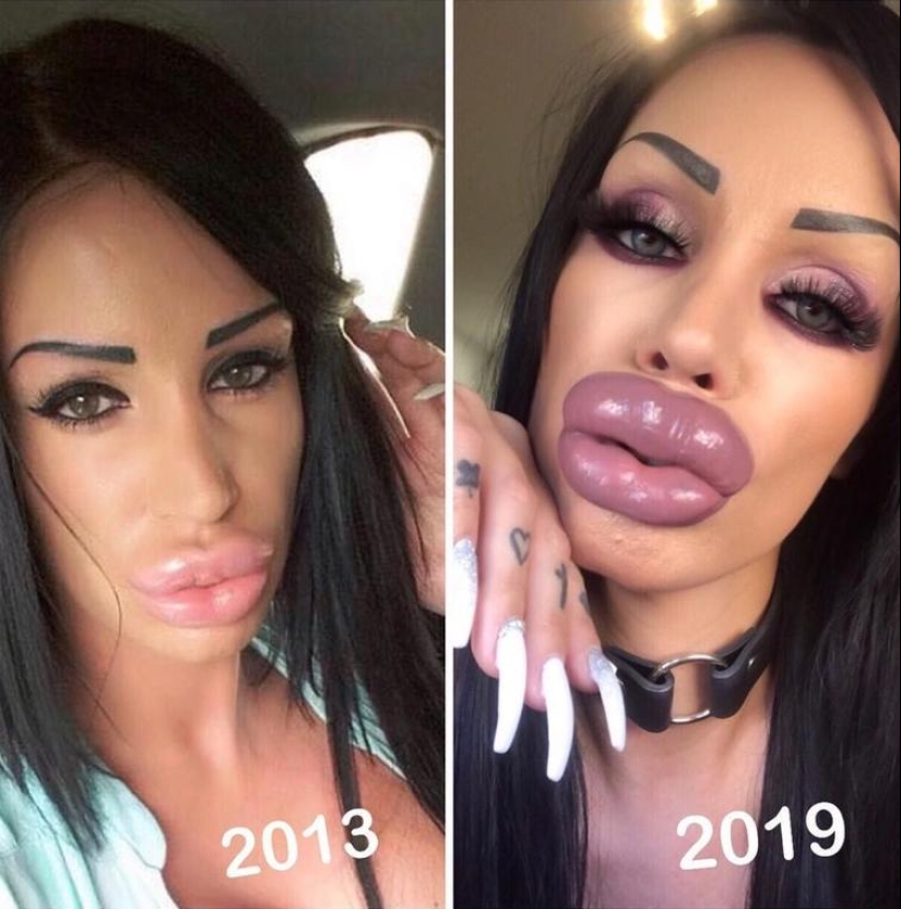 30 people who got carried away with plastic surgery and forgot to stop 30 people who got carried away with plastic surgery and forgot to stop