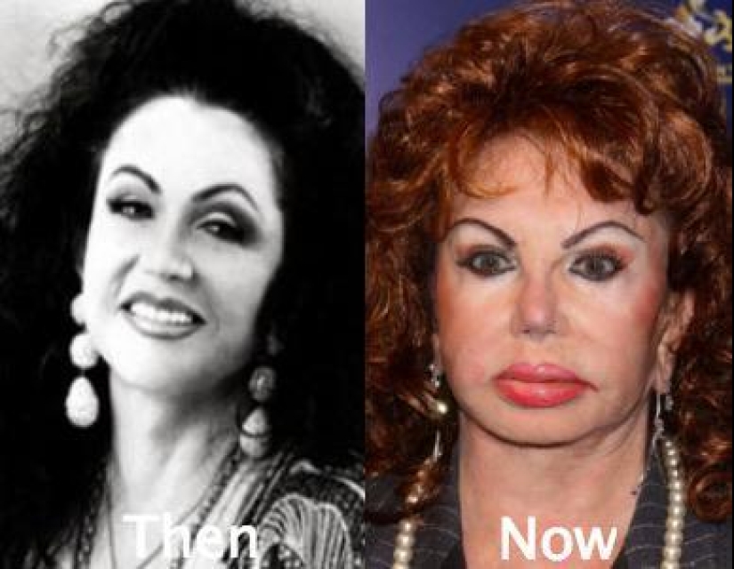 30 people who got carried away with plastic surgery and forgot to stop 30 people who got carried away with plastic surgery and forgot to stop