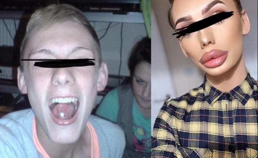 30 people who got carried away with plastic surgery and forgot to stop 30 people who got carried away with plastic surgery and forgot to stop