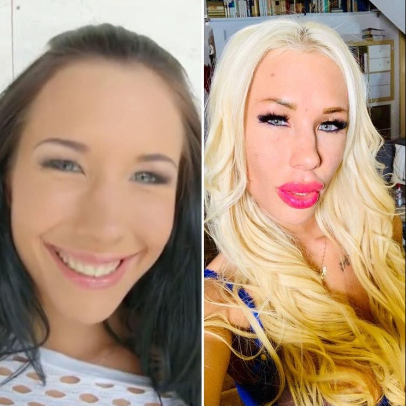 30 people who got carried away with plastic surgery and forgot to stop 30 people who got carried away with plastic surgery and forgot to stop