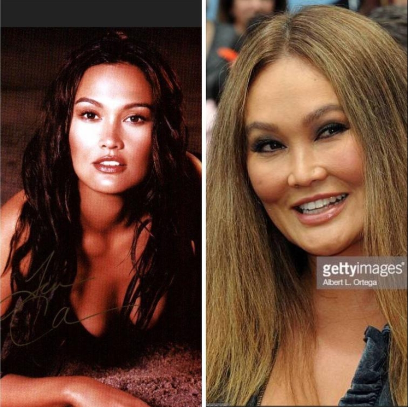 30 people who got carried away with plastic surgery and forgot to stop 30 people who got carried away with plastic surgery and forgot to stop