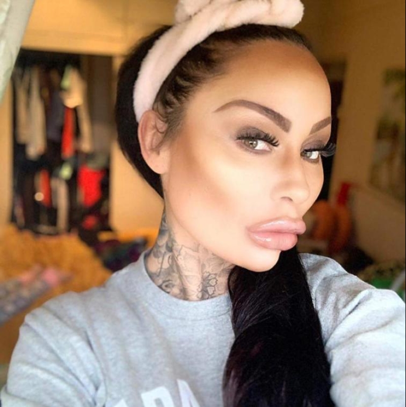 30 people who got carried away with plastic surgery and forgot to stop 30 people who got carried away with plastic surgery and forgot to stop