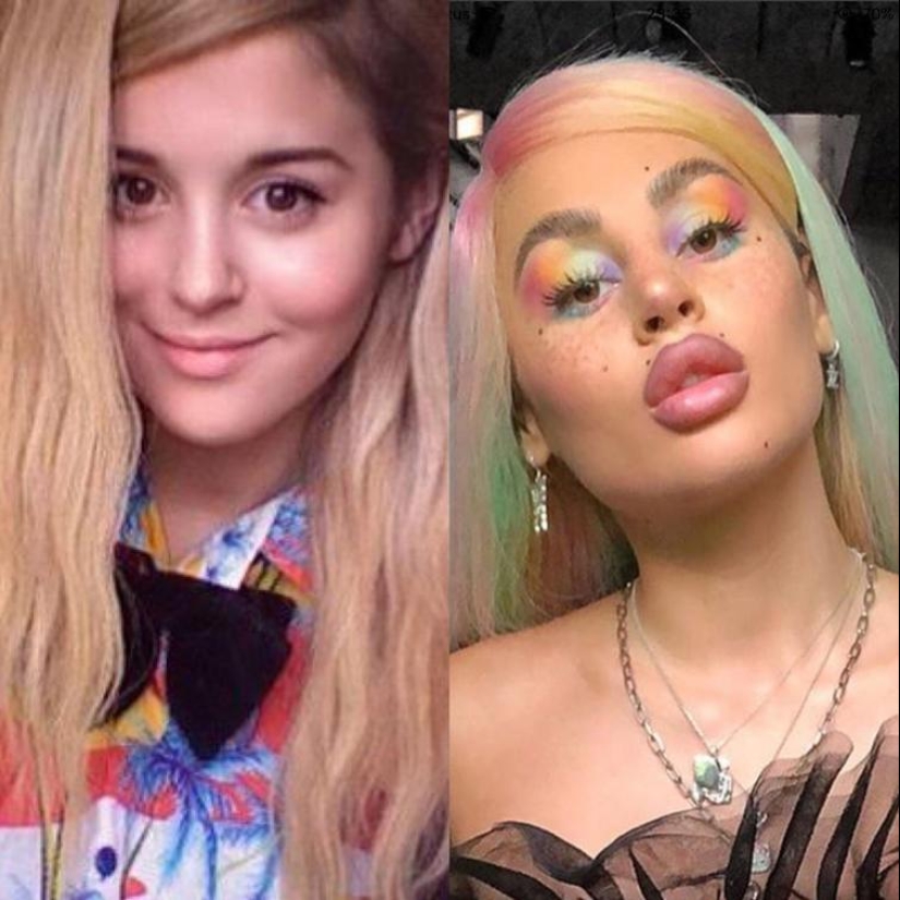 30 people who got carried away with plastic surgery and forgot to stop 30 people who got carried away with plastic surgery and forgot to stop