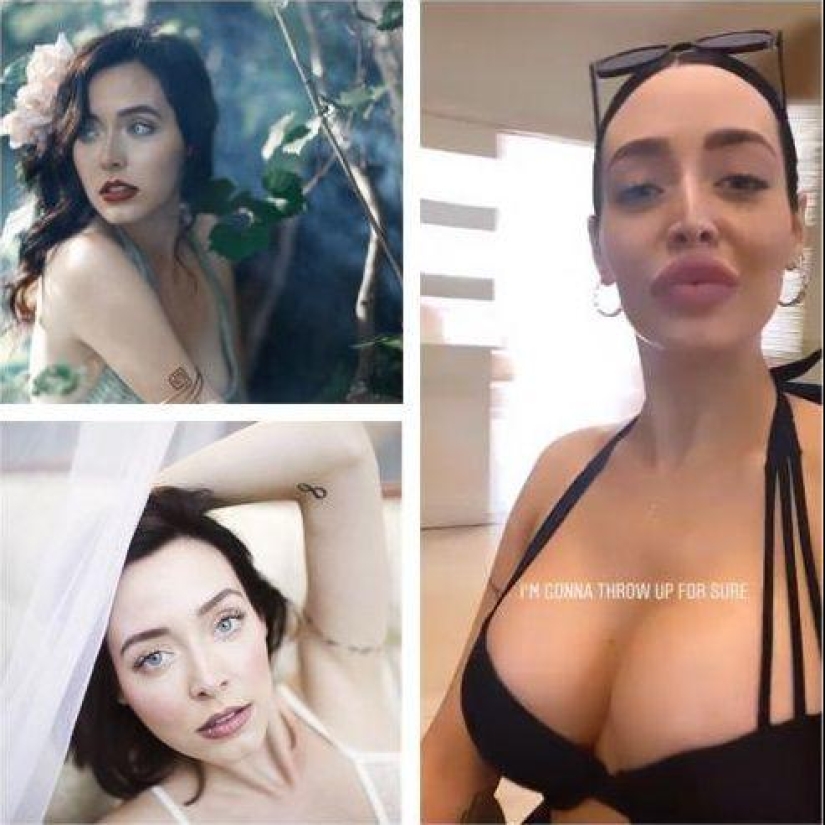 30 people who got carried away with plastic surgery and forgot to stop 30 people who got carried away with plastic surgery and forgot to stop