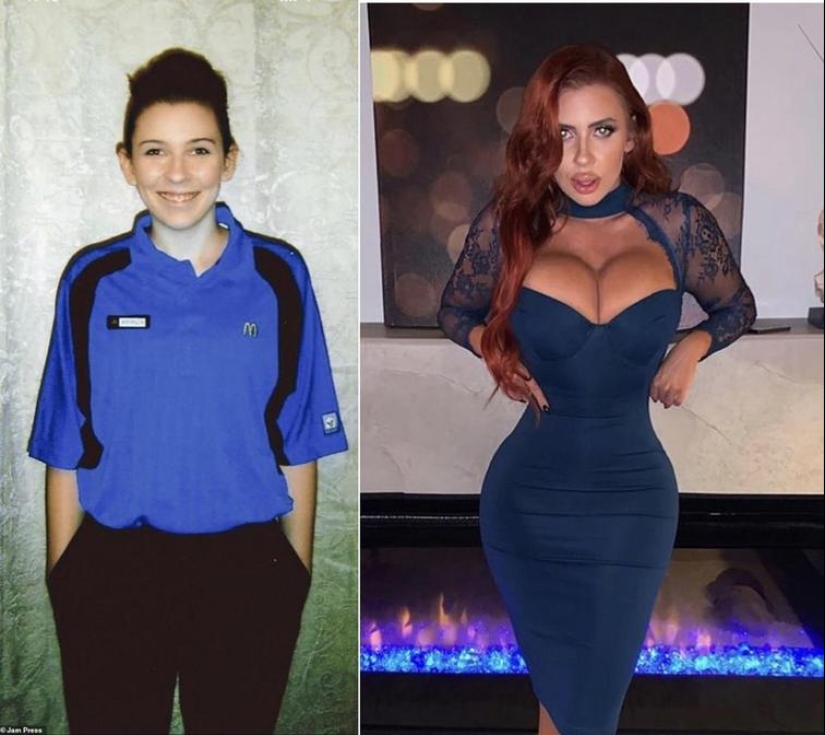 30 people who got carried away with plastic surgery and forgot to stop 30 people who got carried away with plastic surgery and forgot to stop