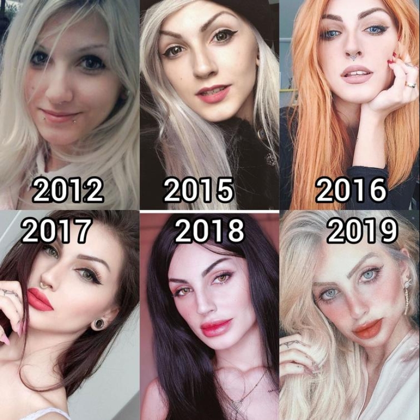 30 people who got carried away with plastic surgery and forgot to stop 30 people who got carried away with plastic surgery and forgot to stop