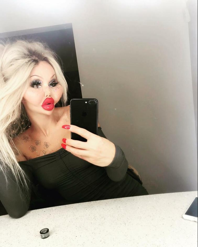 30 people who got carried away with plastic surgery and forgot to stop 30 people who got carried away with plastic surgery and forgot to stop