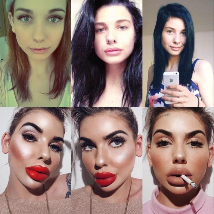 30 people who got carried away with plastic surgery and forgot to stop 30 people who got carried away with plastic surgery and forgot to stop