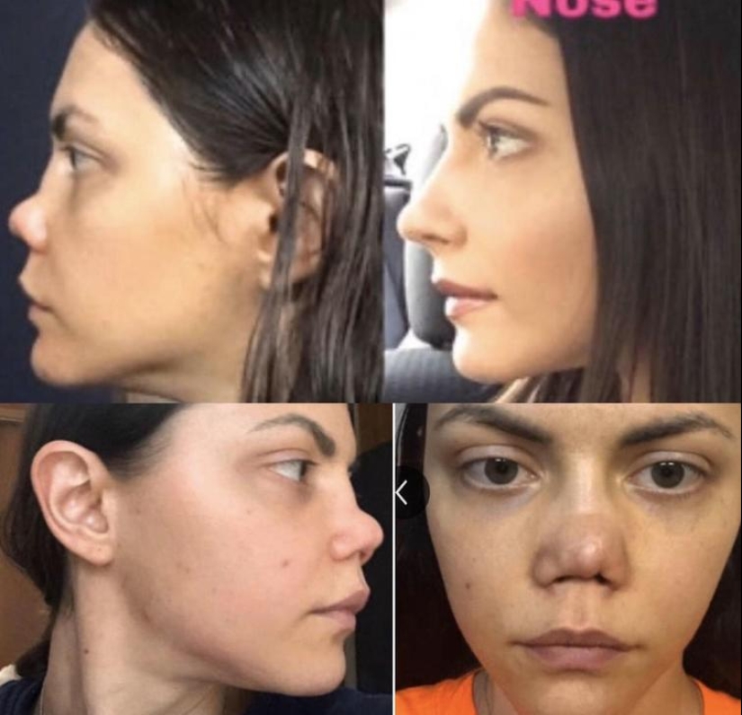 30 people who got carried away with plastic surgery and forgot to stop 30 people who got carried away with plastic surgery and forgot to stop